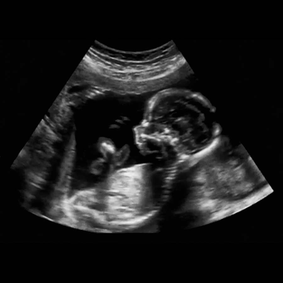 Suivi ostéopathique de la grossesse selon les trimestres à Nyon